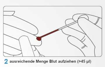 eine ausreichende Menge Blut entnehmen eine ausreichende Menge Blut entnehmen
