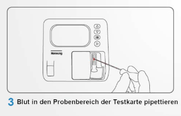 tropfen Sie das Blut in den Probenbereich auf der Testkarte tropfen Sie das Blut in den Probenbereich auf der Testkarte