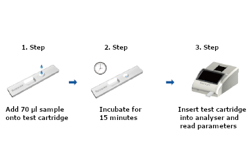 test procedure